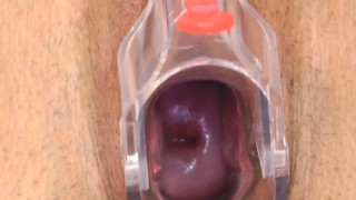 ExposedNurses - Lily